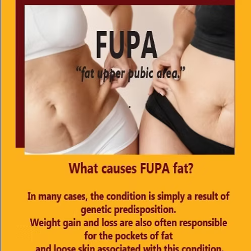 SelecFit (Fupa Slim Tea)