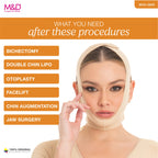 Fajas MyD Accessories MYD0810